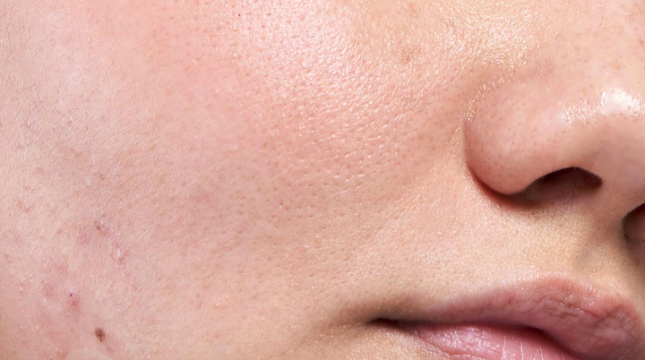 Sebum là gì?