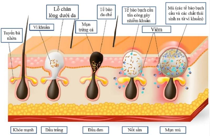 sebum là gì?